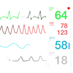 EKG Graphic